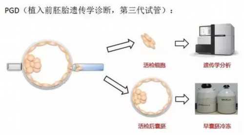 试管取卵