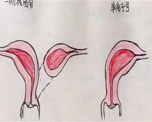 免疫性不孕试管